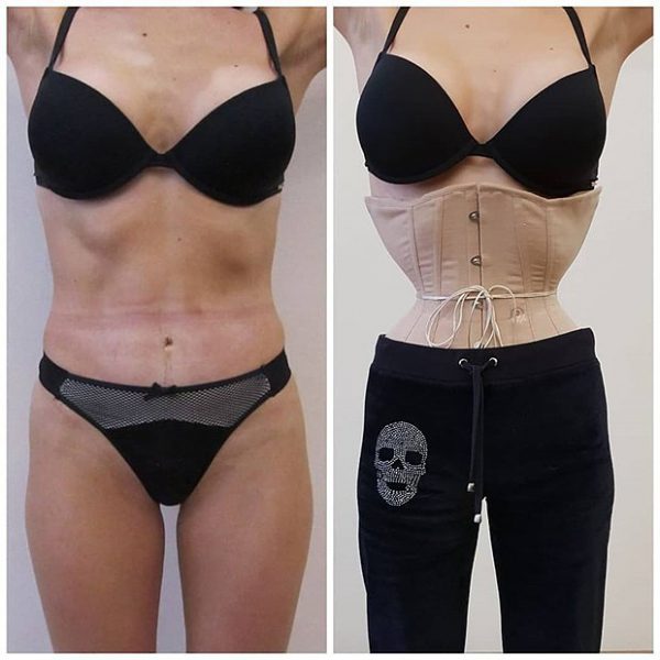 Метод Кудзаева