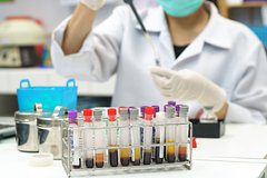 Определен неочевидный фактор нарушения работы имунной системы