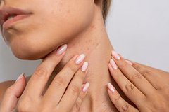 Перечислены семь появляющихся на коже симптомов серьезных заболеваний