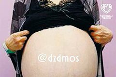 30-килограммовая опухоль выросла на яичнике россиянки