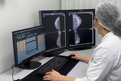 Районные больницы Кабардино-Балкарии оснастили современными маммографами